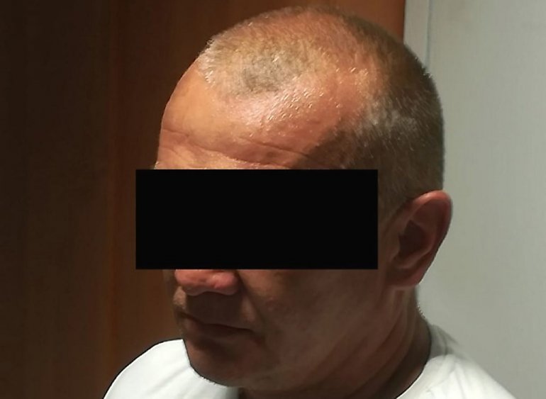 Atakował starsze kobiety. Zrywał złote łańcuszki